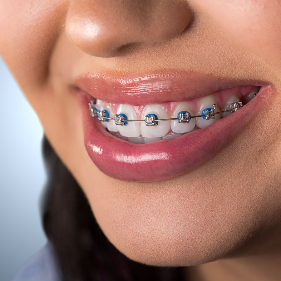 KL Owen braces