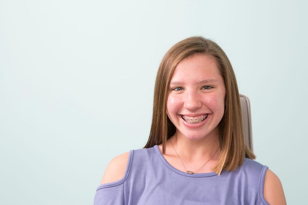 What to Eat Your First Week with Braces (and What to Avoid)